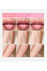 Bright Elegance BE-9020 IPL Lazer Epilasyon 999.999 Atım Manuel/Otomatik Mod Cilt Sensörlü 10 Kademe Ağrısız Lazer